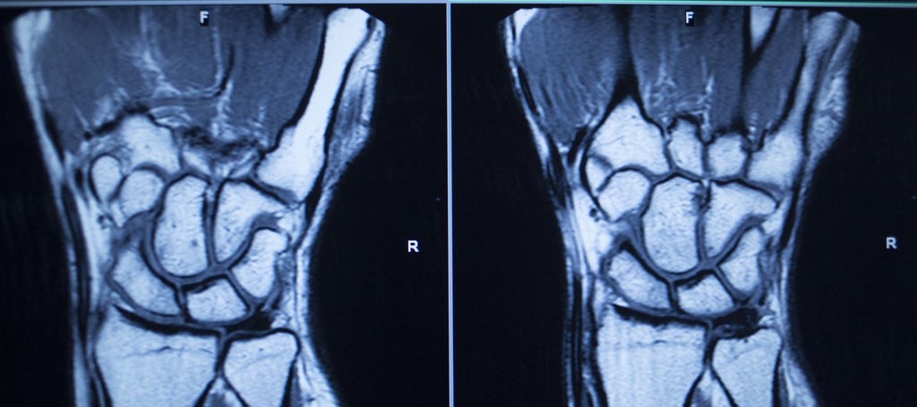 hand-and-wrist-mri-i-med-radiology-network